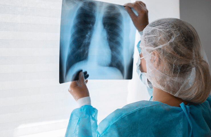 Best Pulmonologist Centre in Sector 45, Noida