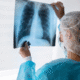 Best Pulmonologist Centre in Sector 45, Noida