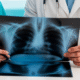 Best X-Ray Centre in Sector 45, Noida