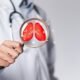 Best Pulmonologist in Noida