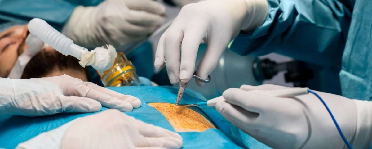 Best IPD Surgery in Noida